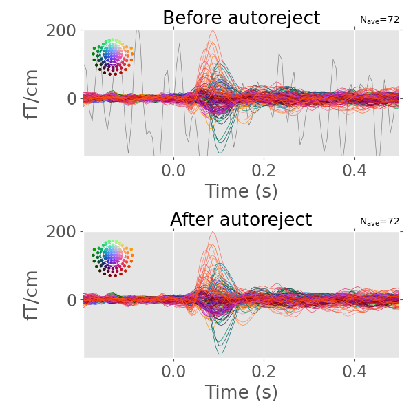 Before autoreject, After autoreject