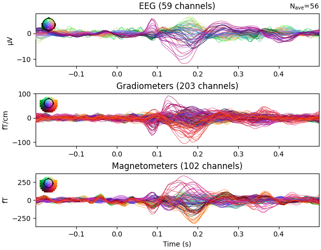 EEG (59 channels), Gradiometers (203 channels), Magnetometers (102 channels)