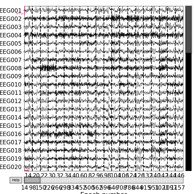 plot visualize bad epochs