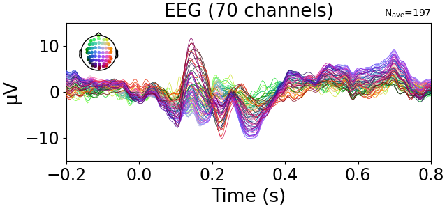 EEG (70 channels)