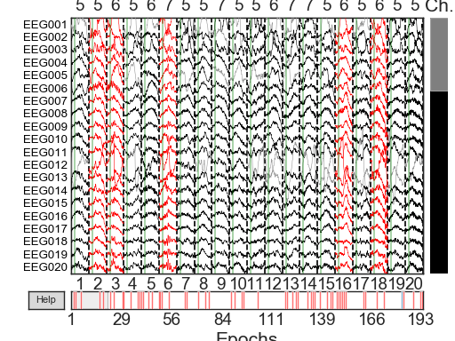 ../_images/sphx_glr_plot_visualize_bad_epochs_002.png