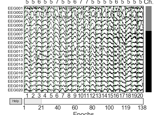 ../_images/sphx_glr_plot_visualize_bad_epochs_003.png