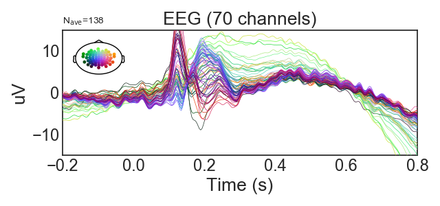 ../_images/sphx_glr_plot_visualize_bad_epochs_006.png