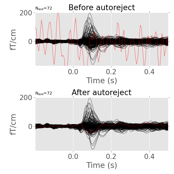 Before autoreject, After autoreject