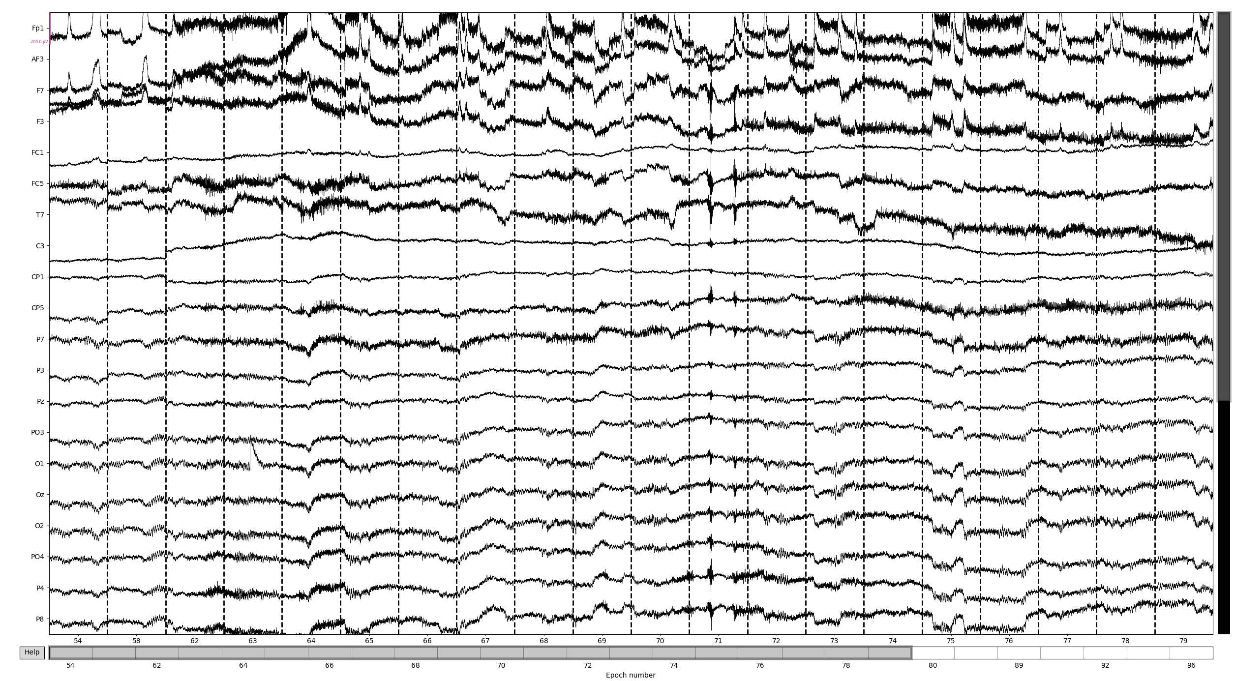 plot autoreject workflow