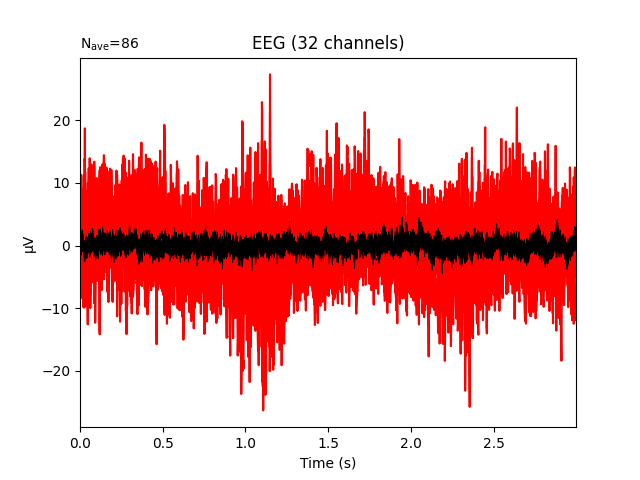 EEG (32 channels)