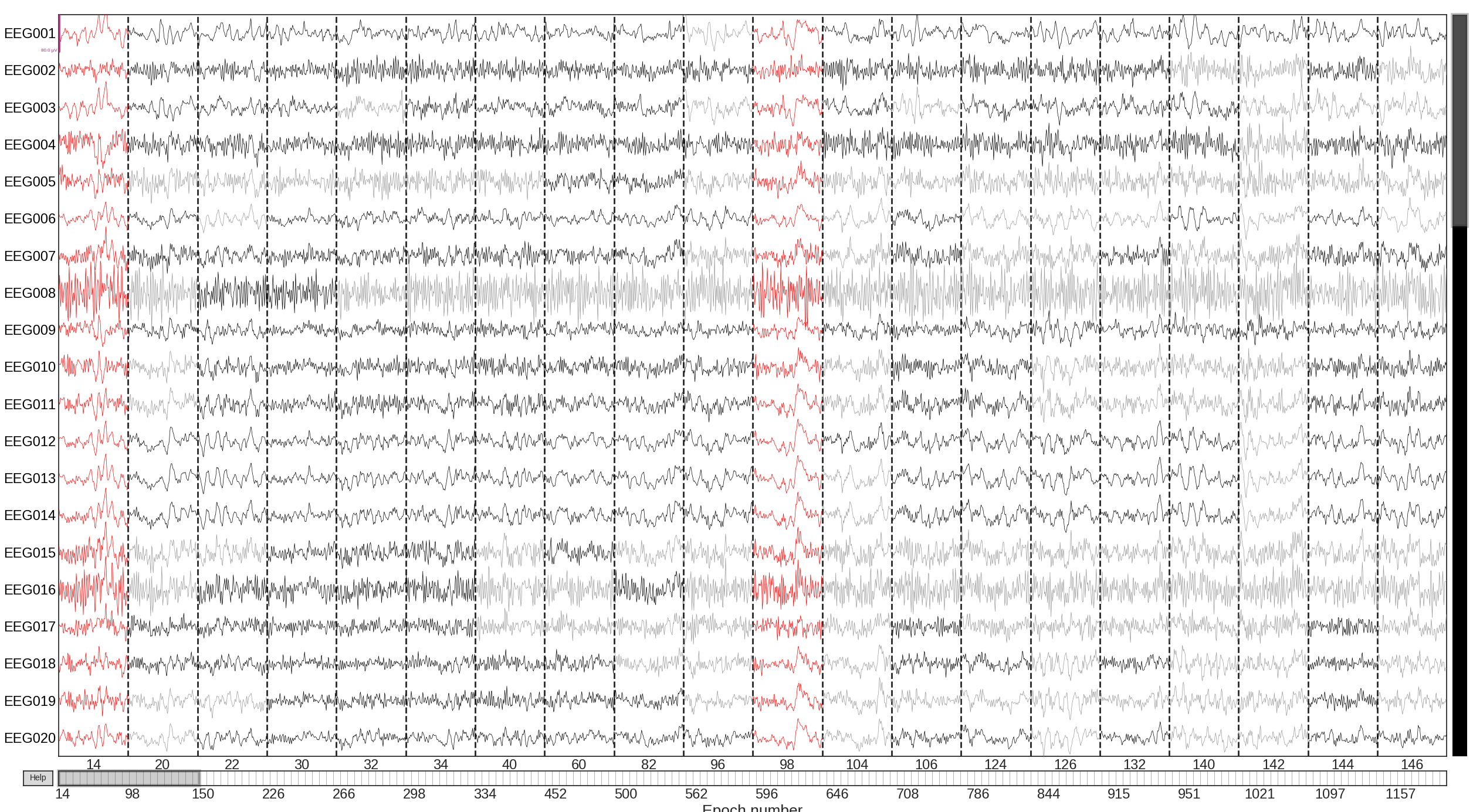 plot visualize bad epochs