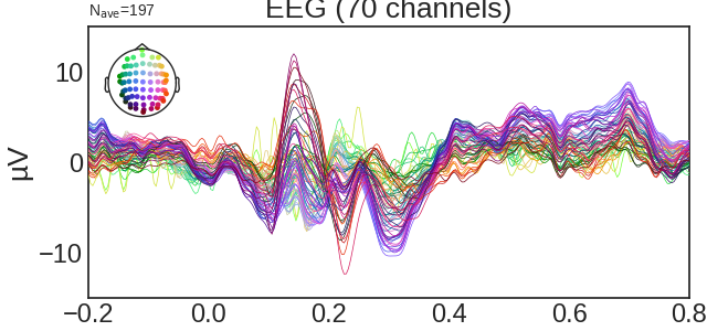 EEG (70 channels)