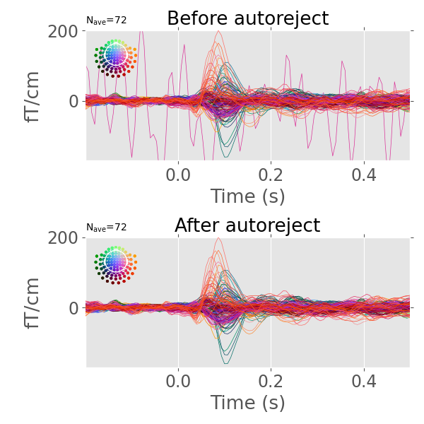 Before autoreject, After autoreject