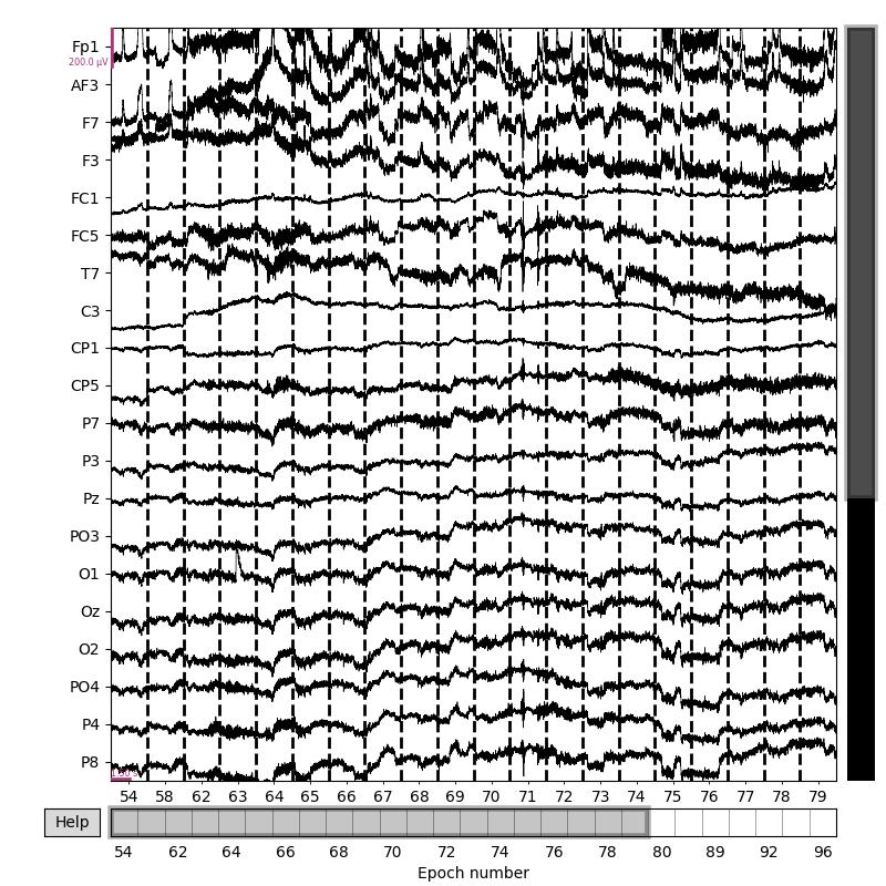 plot autoreject workflow