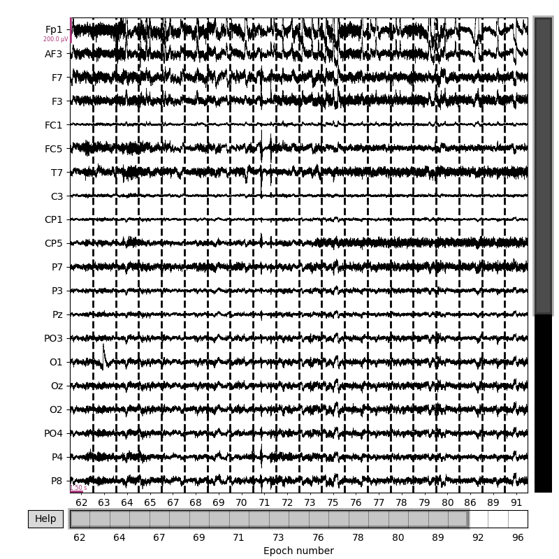 plot autoreject workflow