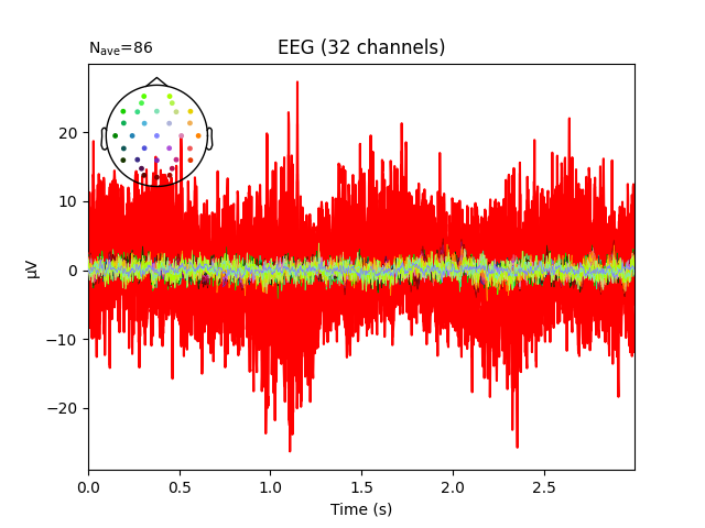 EEG (32 channels)