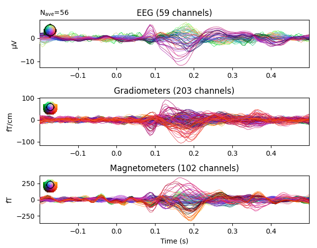 EEG (59 channels), Gradiometers (203 channels), Magnetometers (102 channels)