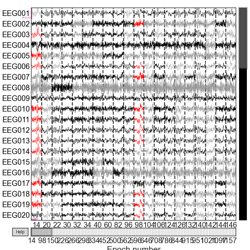 plot visualize bad epochs