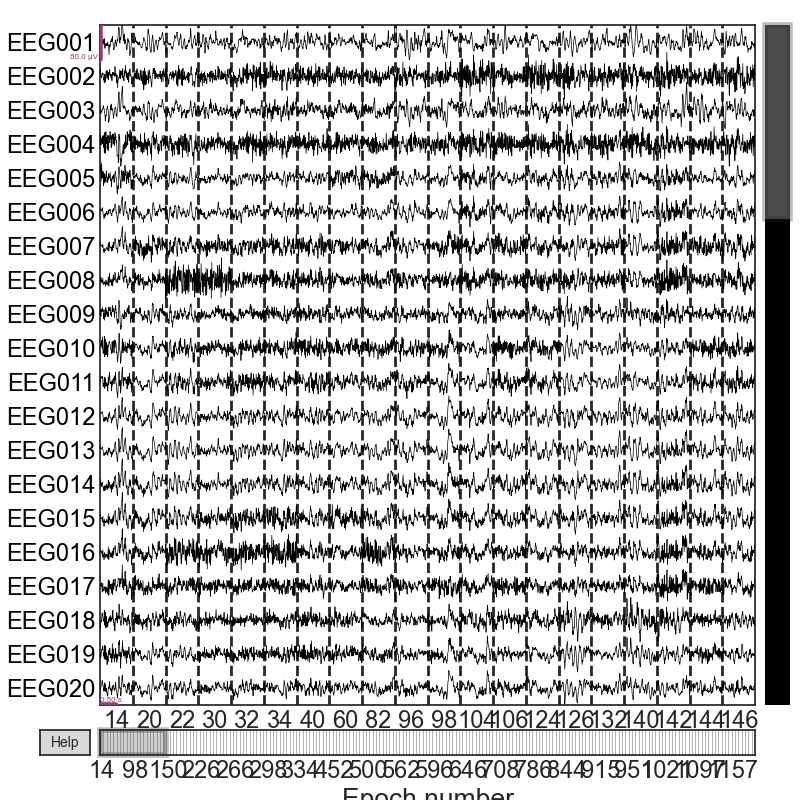 plot visualize bad epochs